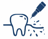 Diş Eti Hastalıkları
